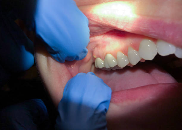 Best After-Hours Dental Trauma Care in Chatmoss, VA