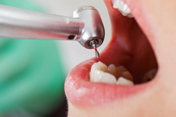 Best After-Hours Dental Trauma Care in Chatmoss, VA